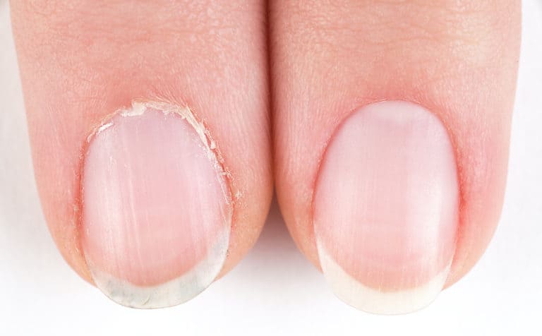 How To Stop Cutting Cuticles – The Best Way