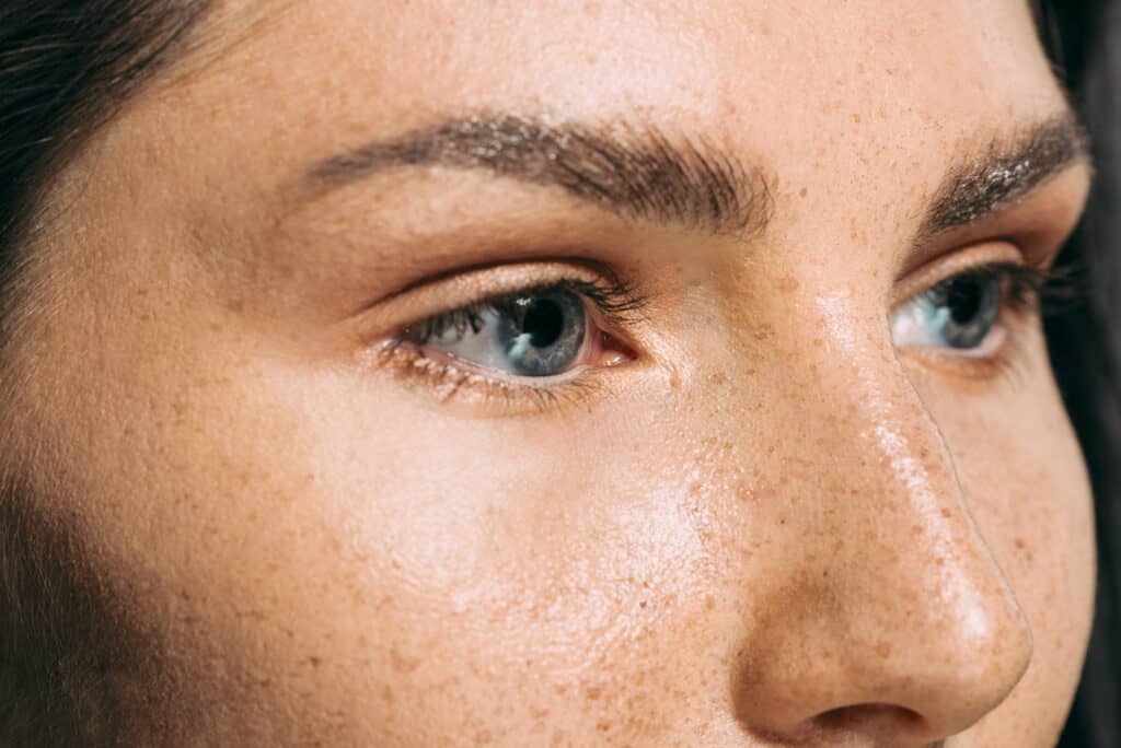 Freckles-2 - Beautygab