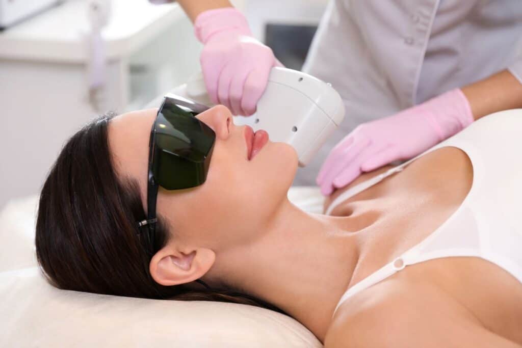 microneedling vs laser for acne scars - Beautygab