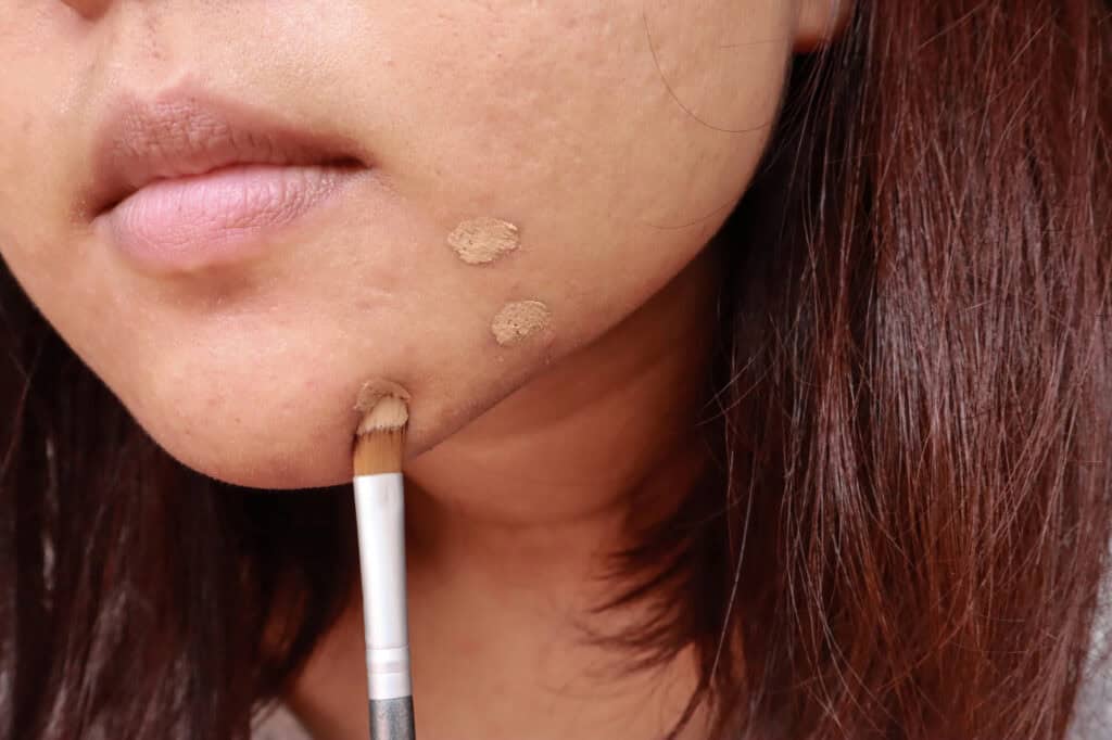 Acne make up coverage - Beautygab Acne make up coverage