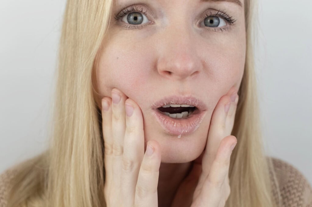 dry face - Beautygab dry face