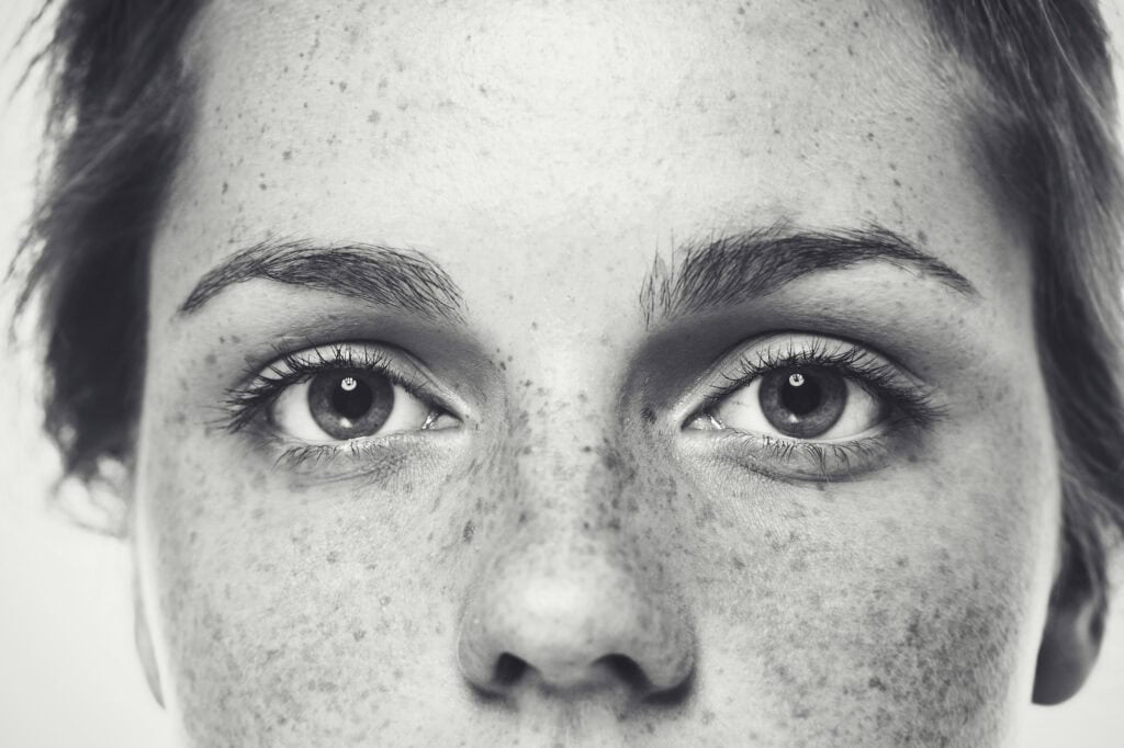 Freckles - Beautygab Freckles