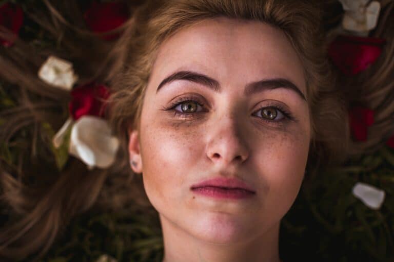 Freckles
