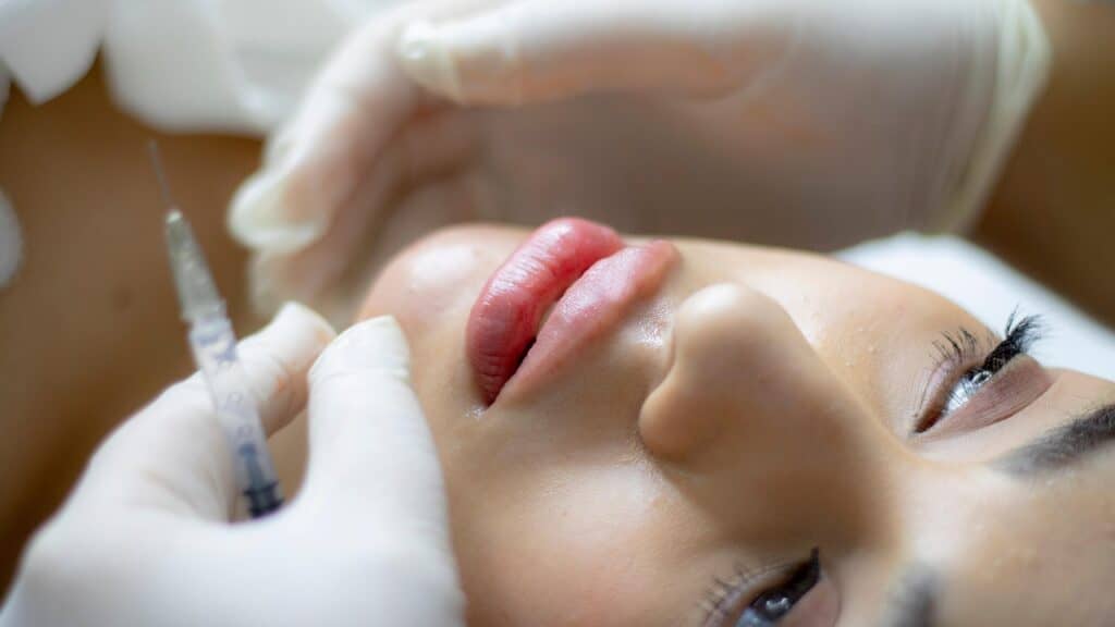 Lip Injections - Beautygab Lip Injections